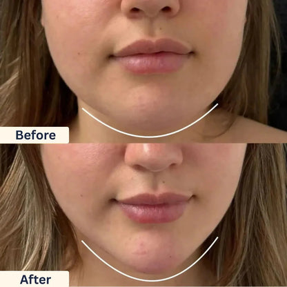 The Original Lymphatic Contour Face Brush
